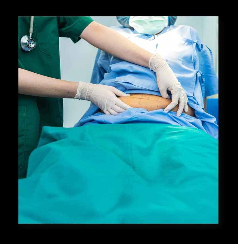 Bariatric Surgery