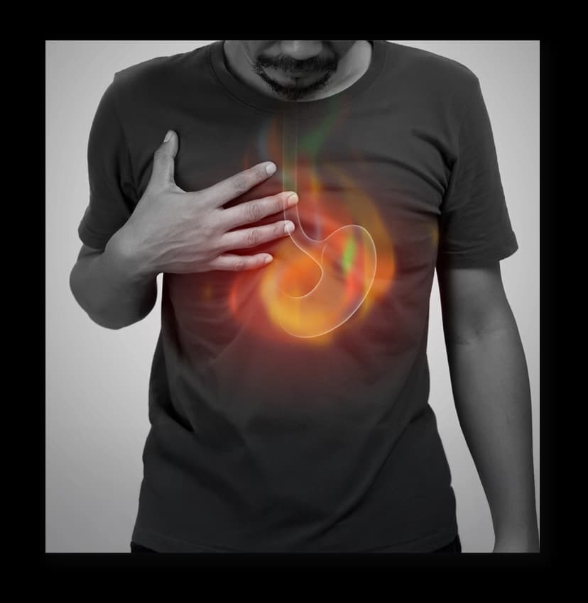 Surgery for Reflux Disease